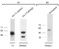AKIN ß gamma in the group Antibodies Plant/Algal  / Plant Developmental Biology / Plant Signal Transduction at Agrisera AB (Antibodies for research) (AS09 463)